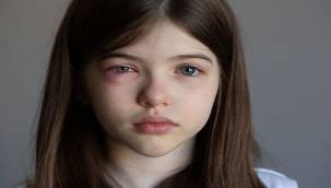 Baharda göz sağlığı için önemli öneriler!