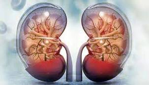 KÜÇÜK BÖBREK TAŞLARI AĞIR SONUÇLAR DOĞURABİLİYOR!